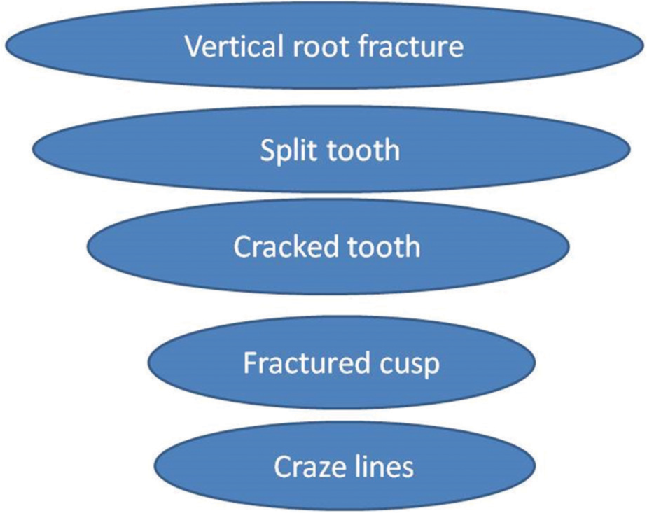 Types of longitudinal fracture from least to severe.