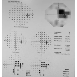 Article figure