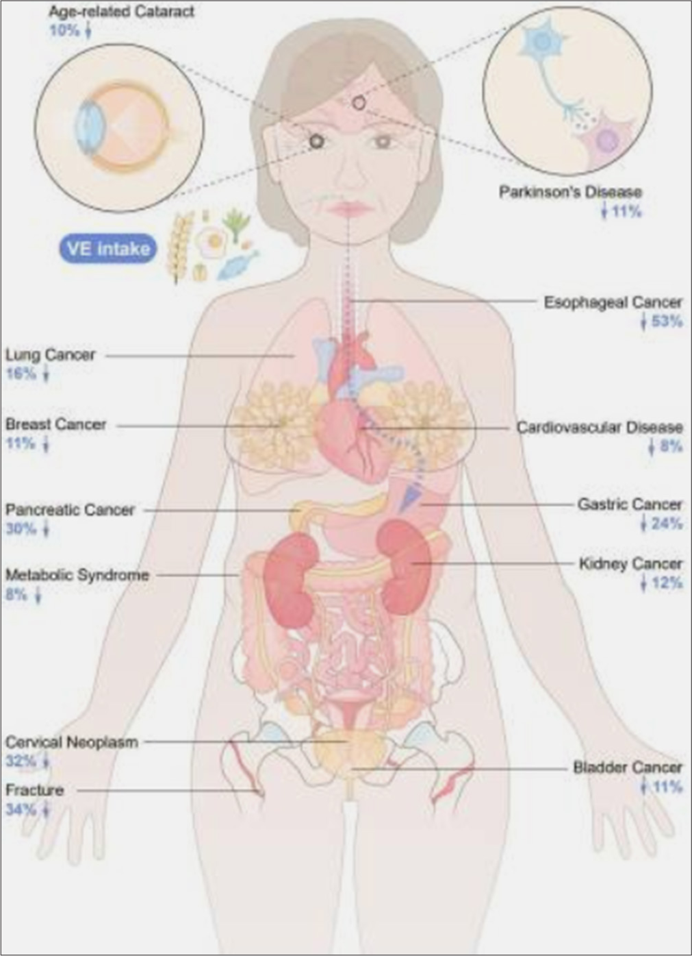 Diagrammatic Representation of Vitamin E in different diseases (Source: Zhang et al., 2023) Vitamin E intake and multiple health outcomes: An umbrella review. Frontiers in Public Health.